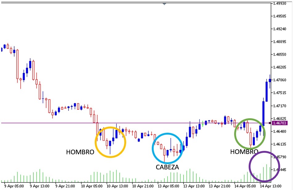 la formacion de Hombro Cabeza Hombro